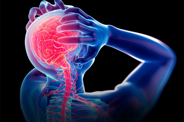 Migraine Associated Vertigo American Migraine Foundation